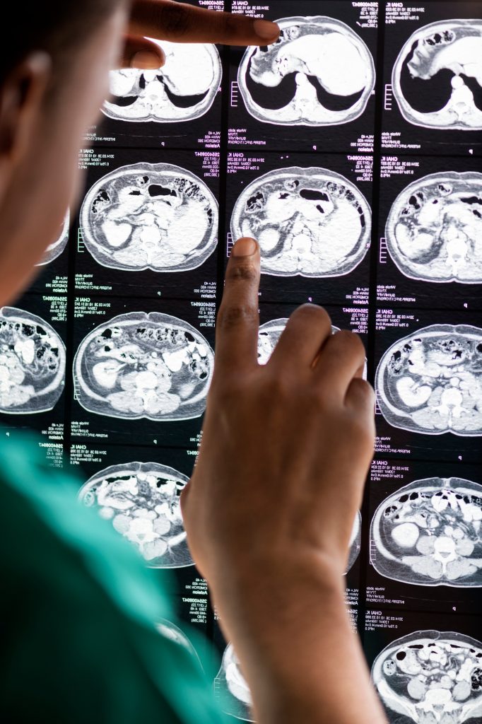 Doctor reading brain MRI x-ray result